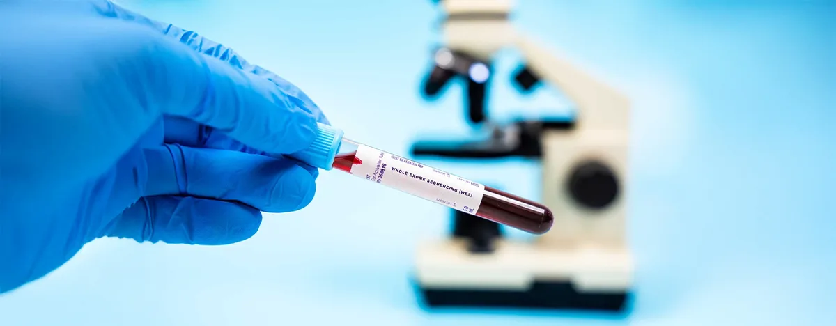 Whole Exome Sequencing (WES)-Test