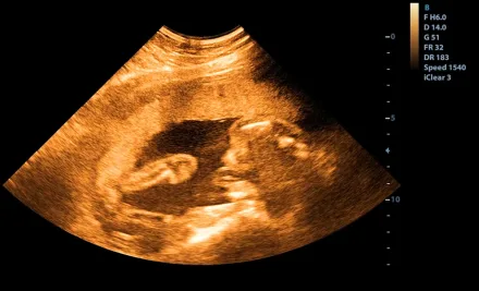 IVF Kosten Zypern: Aktuelle Preise und ausführlicher Ratgeber